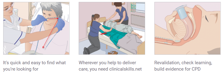 Illustration from ClinicalSkills